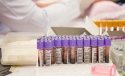 April 2017’s HIV/AIDS Statistics: A Breakdown