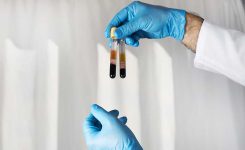 2 Donated Blood Packs Tested HIV-Positive